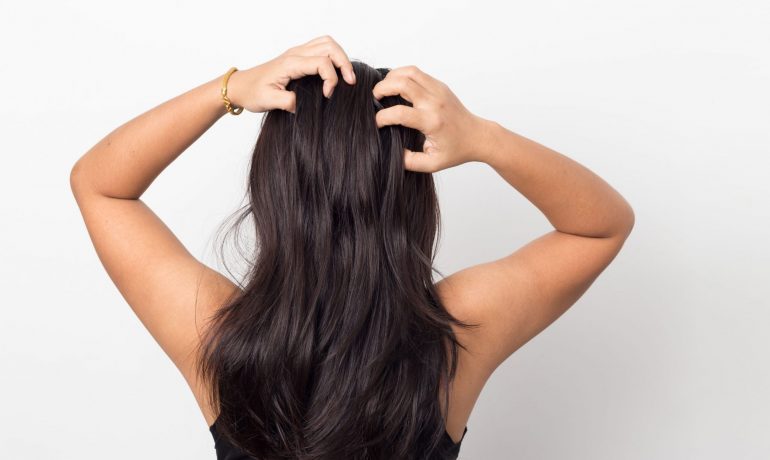 Warum juckt die Kopfhaut wenn die Haare fettig sind?